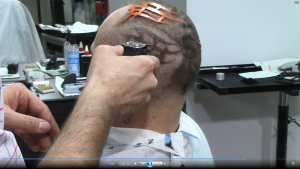 Photo du vidéo: tattoo capillaire