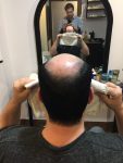 prothese capillaire pour homme Rive-Sud de Montreal-RJOCoiffure.com