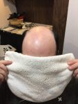 prothese capillaire pour homme-rjocoiffure.com